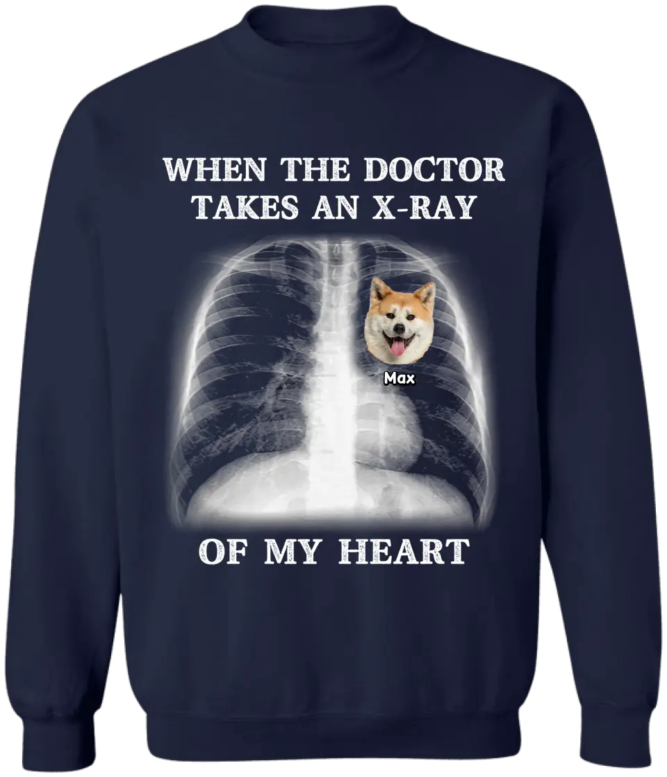 When The Doctor Takes An X-ray Of My Heart - Personalized T-Shirt, Gift for Dog Lovers