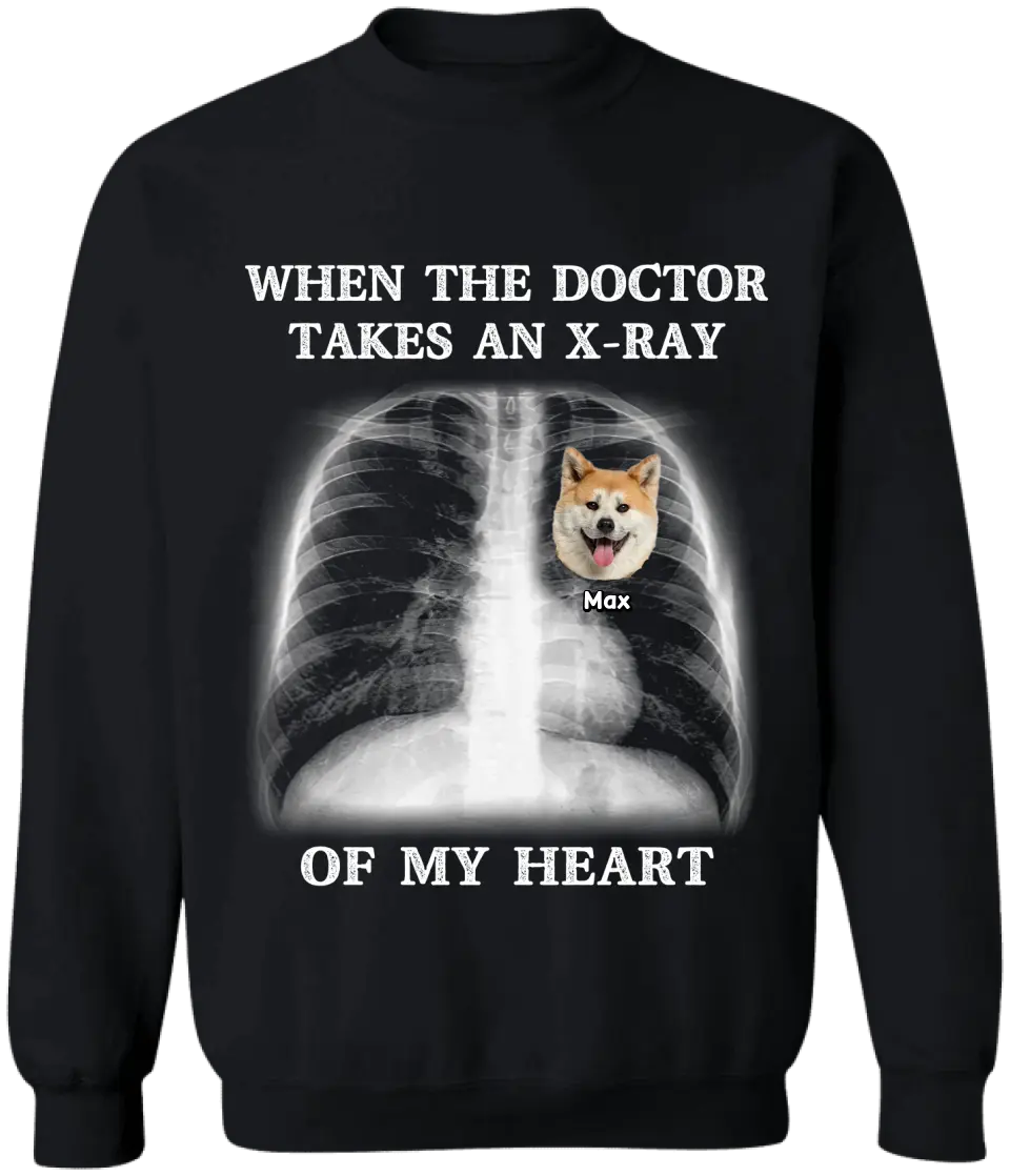 When The Doctor Takes An X-ray Of My Heart - Personalized T-Shirt, Gift for Dog Lovers