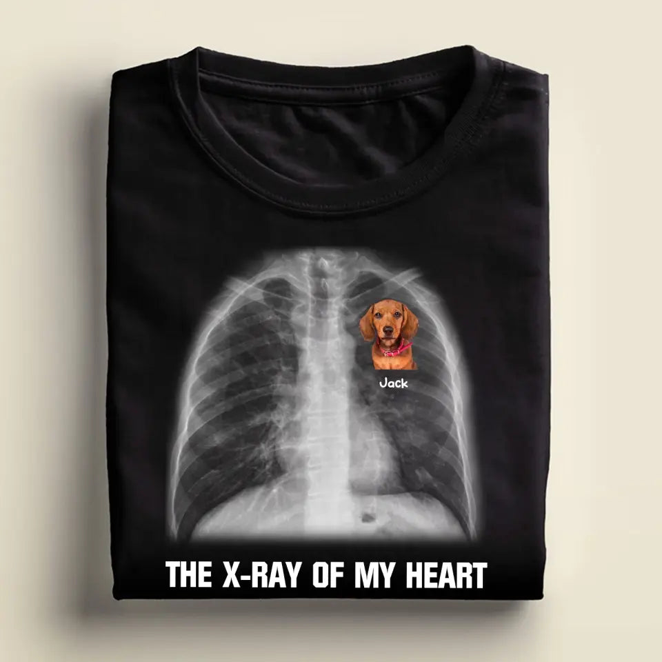 Text X-ray Of My Heart - Personalized T-Shirt, Gift For Dog Lover - TS19UP