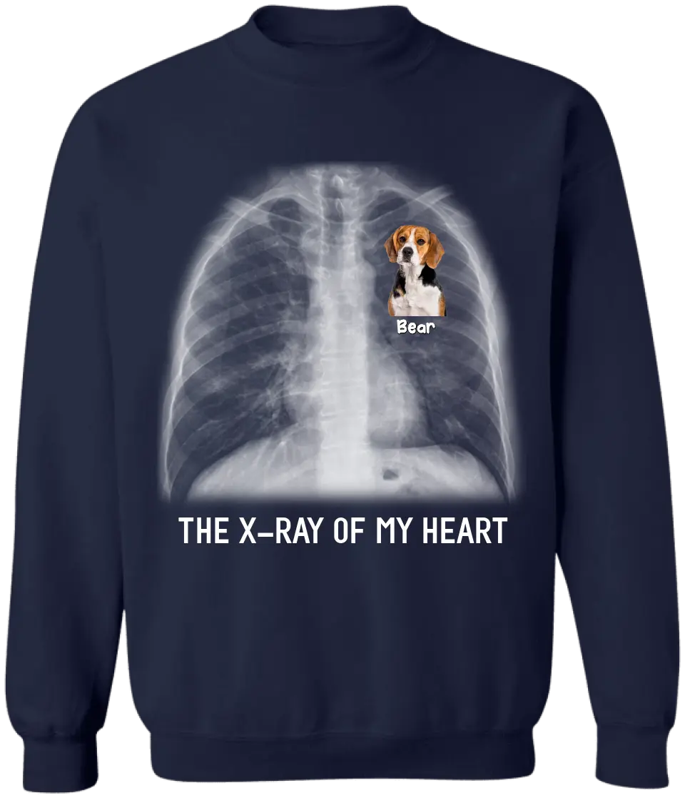 Text X-ray Of My Heart - Personalized T-Shirt, Gift For Dog Lover - TS19UP