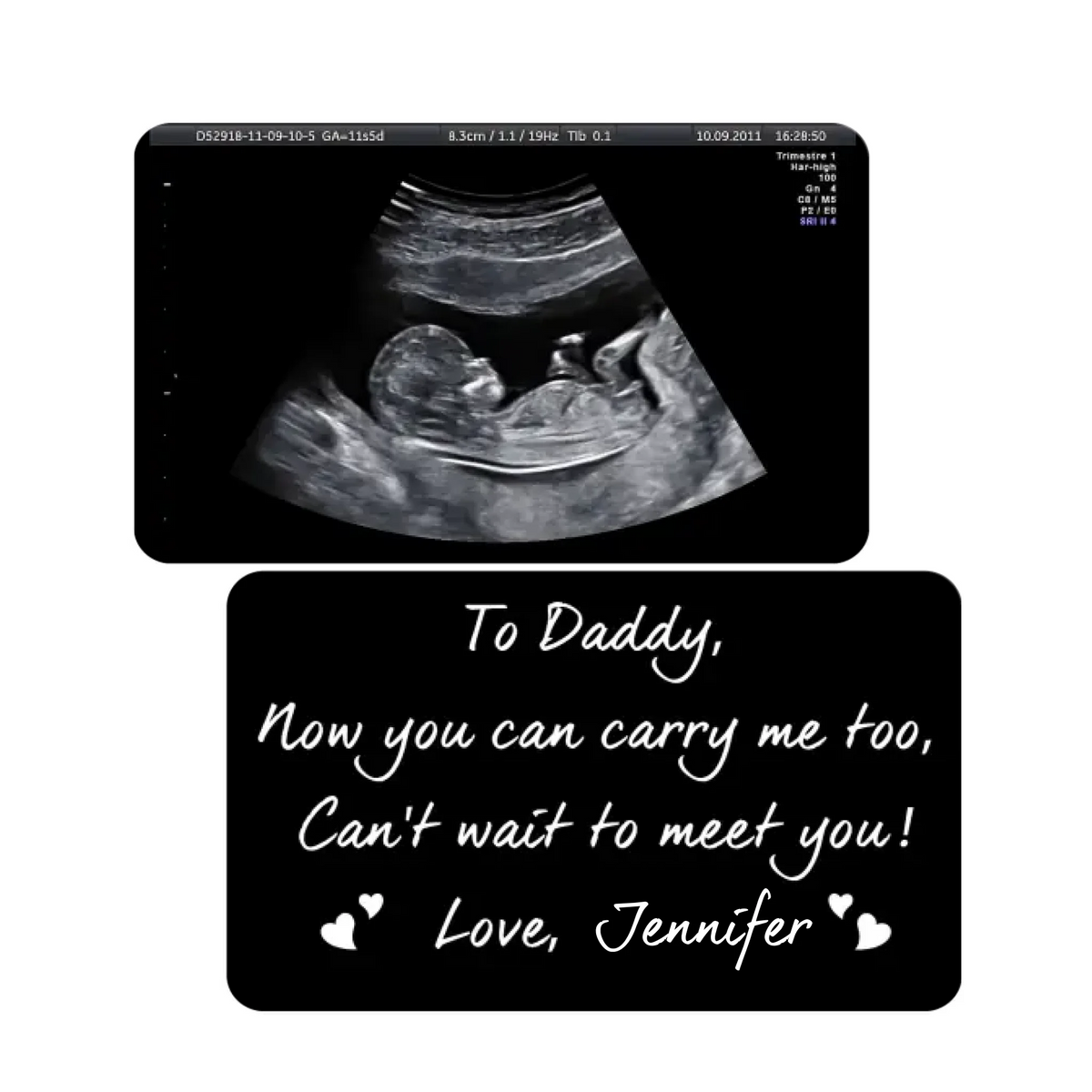 Now You Can Carry Me Too - Personalized Wallet Card, First Dad Gift, New Dad To Be
